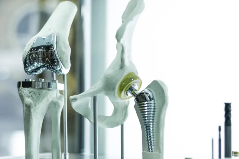 CNC precision machined orthopedic knee and hip joint replacement implants in titanium alloy and cobalt chrome with mirror polished articulating surfaces and threaded femoral stem — custom medical device CNC machining for orthopedic implant OEM manufacturing